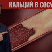 Кальцификация