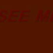 Herve See Me