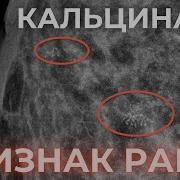 Матрица Горяева Молочных Желез
