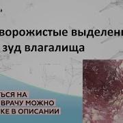 Эротические Видео Выходят Белые Комочки Из Вагины