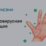 Инфекция