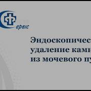Выведение Камней Из Мочевого Пузыря