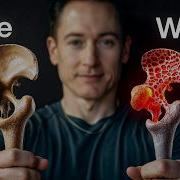 Troubleshooting Bones
